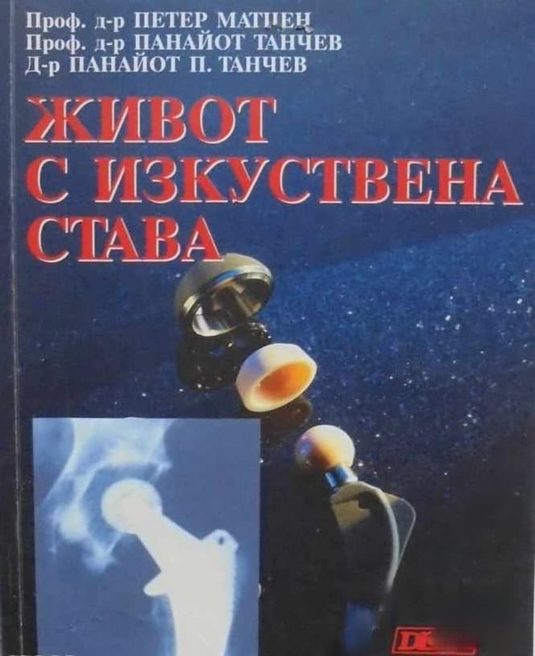 Живот с изкуствена става — cover